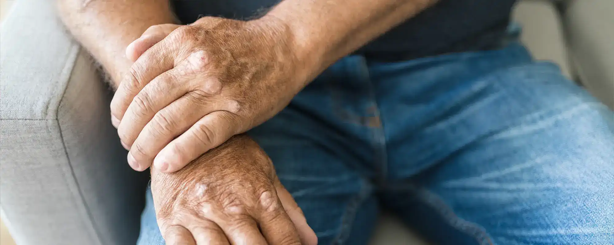 arthritis-